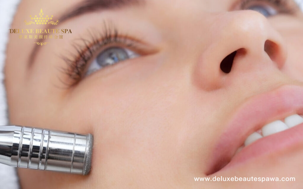 Diamond-Microdermabrasion-Our-Service-